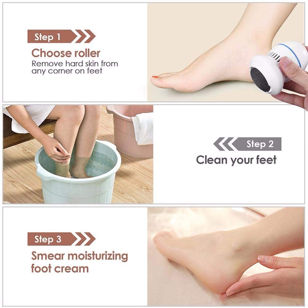 Callus Remover with Built-In Vacuum Rechargeable Motorized Electric Feet Foot File Pedicure Tool Exfoliation Dead Skin