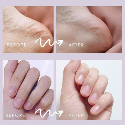 Callus Remover with Built-In Vacuum Rechargeable Motorized Electric Feet Foot File Pedicure Tool Exfoliation Dead Skin