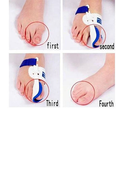 Orthopedic Hallux Valgus  Bunion Corrector Splints (1 Pair)